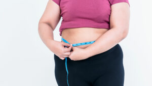 Reconstruction de l’obésité (post-bariatrique)